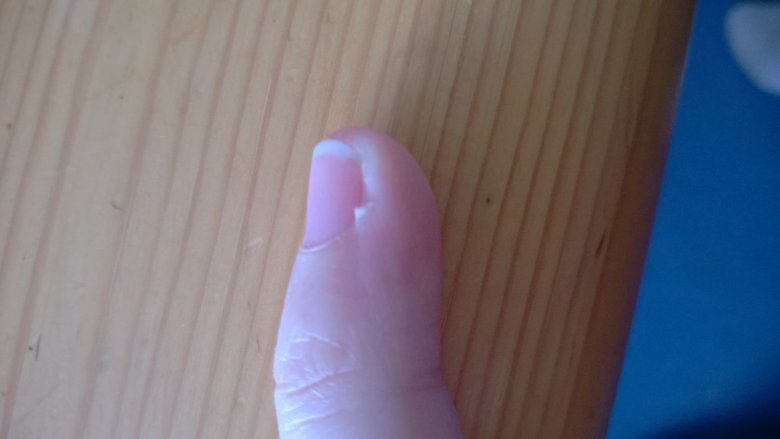 Kleiner Finger Nagelhaut komisch in Maniküre