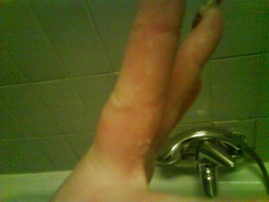 ja, meine finger sehen auch nich grade schön aus :( kann die haut da schon  Eventuelle Allergie wegen Modellage? in Kosmetik / Mode