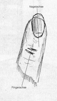 Skizze von einem Finger mit schräg stehenden Naturnagel Schräg sitzender Fingernagel, was tun? in Tipps / Tricks
