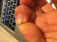 Abgebrochener Finger auf dem Heimweg. Woran erkenne ich gut gemachte Gel-Nägel? in Gelnägel
