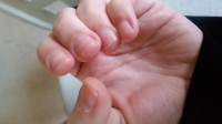 Meine Nägel :( Können Tips geklebt werden? in Anfänger Nageldesign