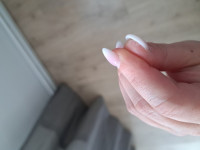 Haut Daumen Haut Fingerkuppen löst sich nach Modellage in Nagelkrankheiten