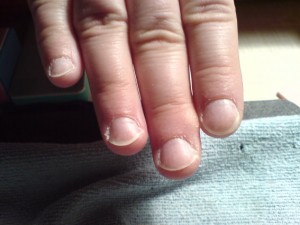 Anna rechte Hand  Schablonenverlängerung an ganz winzigen Fingern ? in Gelnägel