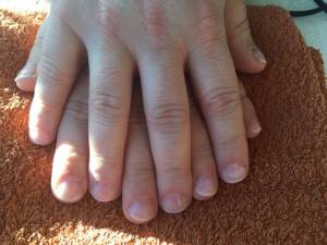 Die Hände nach der Modellage Nagelbeisser (mein Mann) Fingernägel gemacht in Nägel kauen