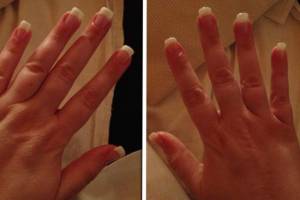 Linke und rechte Hand Schreckliche Erfahrung mit Nagelstudio in Gelnägel