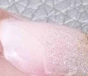 Nahansicht Riss im Nagel - wie vorgehen, welche Gründe? in Nagelmodellagen