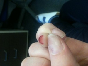 Bitte meine anderen Finger nicht beachten =) Probleme mit ersten Acrylnägeln in Anfänger Nageldesign