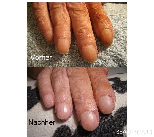 Maniküre beim Mann Vorher / Nachher - Habe meinem Opa (stolze 83 Jahre alt) eine Maniküre gemacht Nailart