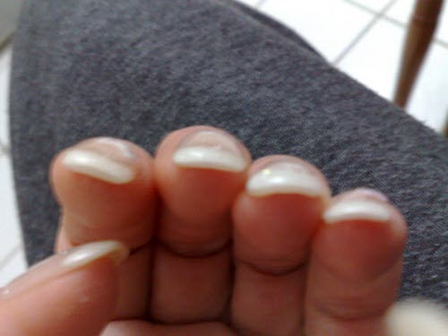 Gekürzte Nägel Gelversuche, möchte wissen was alles falsch ist. in Anfänger Nageldesign