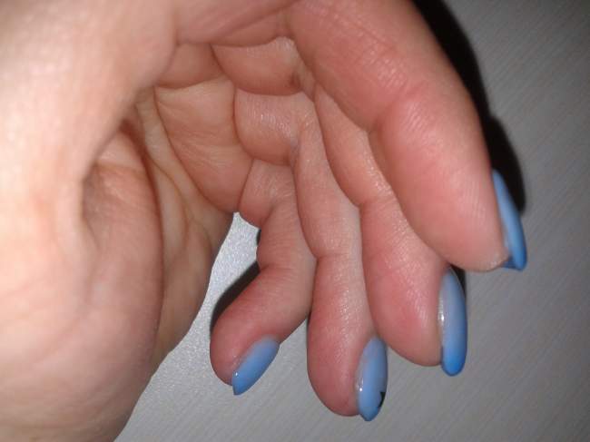 Gelnägel mit Schabi und Thermogel Blau Aufbau Verlängerung Schabi mit Gel und Thermogel in Anfänger Nageldesign