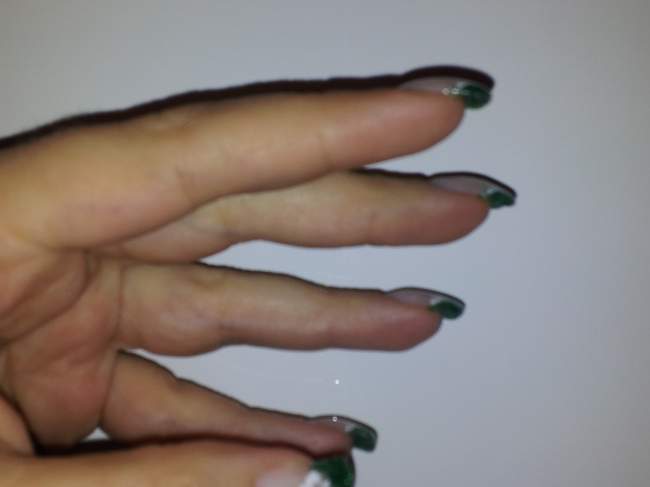  Schablonen Verlängerung mit Glitzergel- Meinungen? in Anfänger Nageldesign