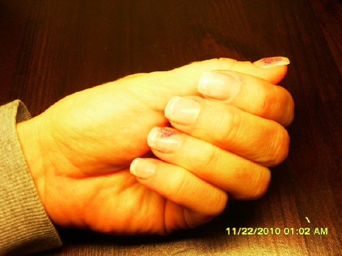  5. Refill in Anfänger Nageldesign