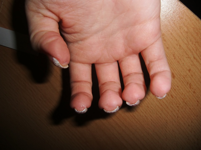 Tunnel rechts weiß/rotes Glitzerfrench - Gelnägel - 1. Modellage in Anfänger Nageldesign