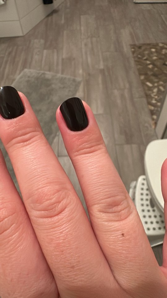 Rötung am Ringfinger Entzündung in Gelnägel