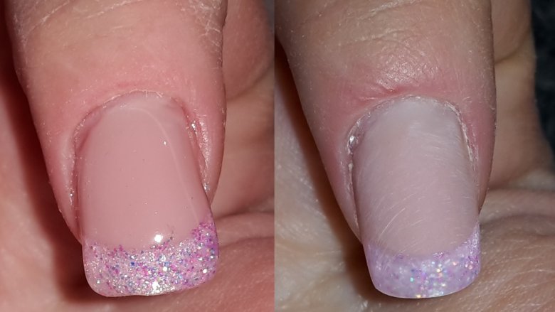 Ich liebe vorher-nachher-bilder...fällt fast gar nicht auf :)
Rosa-Pink  1-Finger Projekt in Anfänger Nageldesign