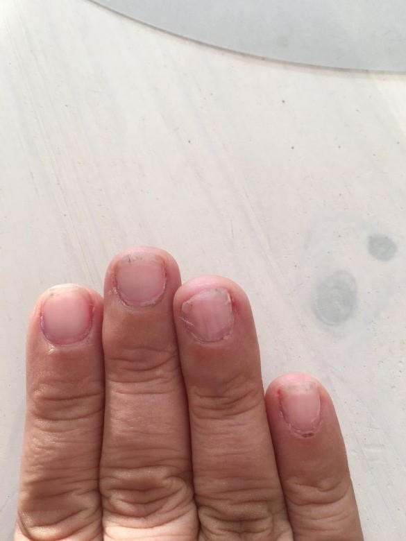 rechte Hand Woran erkenne ich gut gemachte Gel-Nägel? in Gelnägel