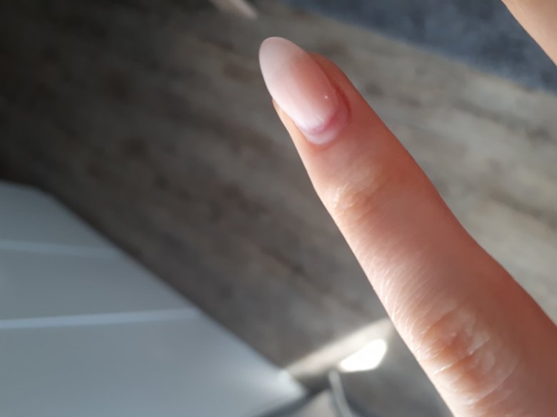 Ebenfalls der kleine Finger Naturnagel zu dünn gefeilt? Oder was anderes? in Acrylnägel