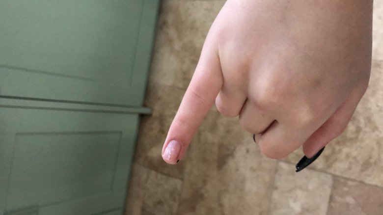 Bild nachdem ein Nagel abgegangen ist Nägel gehen immer ab? in Anfänger Nageldesign