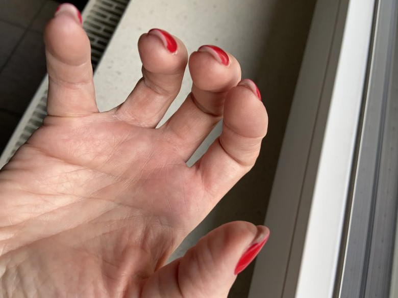 Hier sieht man, dass rehct viel Material unter dem Nagel ist Sind das professionell gearbeitete Nägel? in Gelnägel