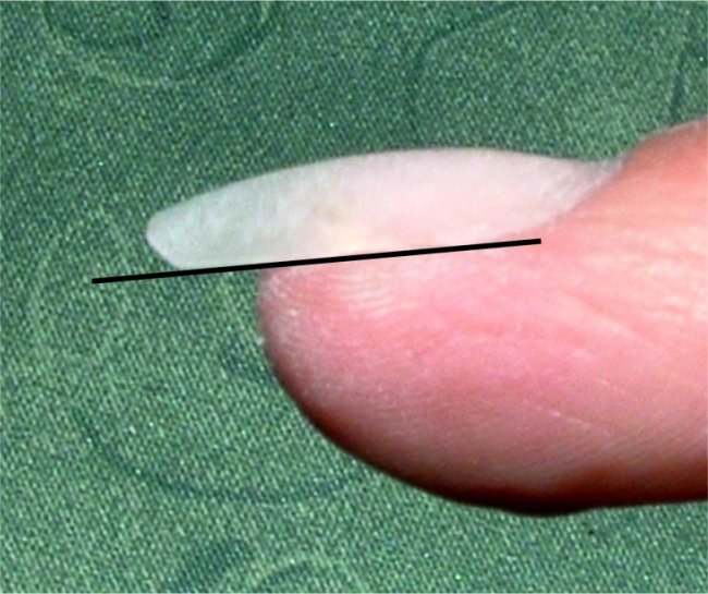  Anfängermodellage die erste :) in Anfänger Nageldesign