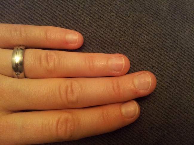 Finger linke Hand Tips oder Schablone bei Anfänger und Nagelkauer in Anfänger Nageldesign