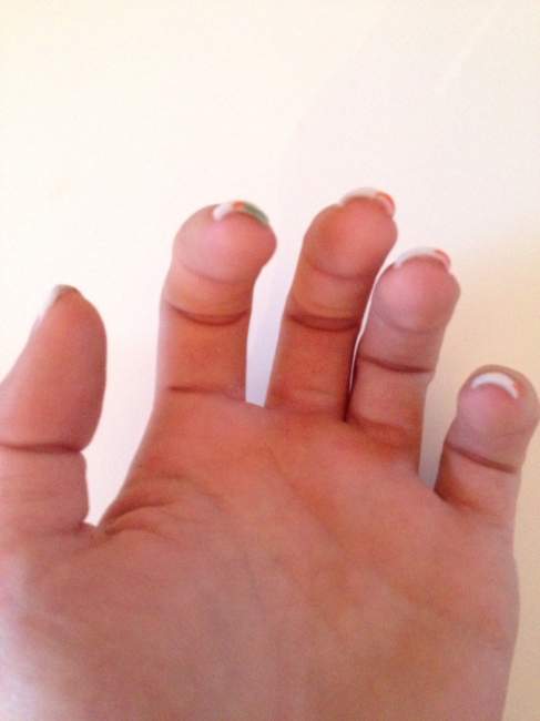 Ansicht unten linke Hand Erste Acryl Modellage auf beiden Händen in Anfänger Nageldesign
