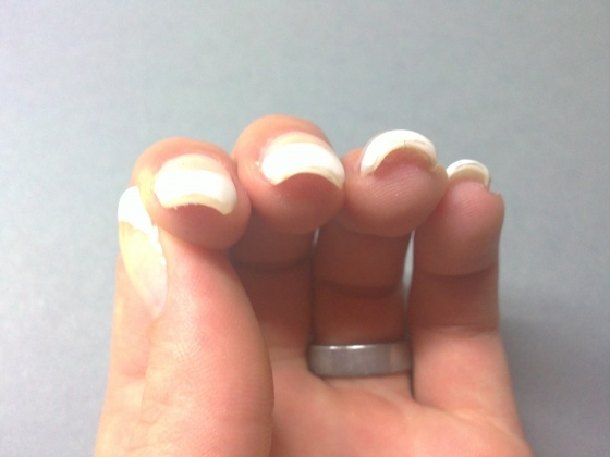 hand 3 Meine neuen Nägel in Anfänger Nageldesign