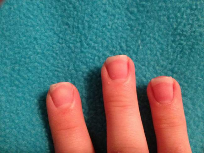 Meine Fingernägel natur Nägel gehen in die Breite - habe ich Problemnägel? in Nageldesign