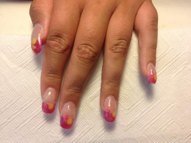 Vorher Acrylnails von ND Acrylnägel vorher - nachher in Acrylnägel