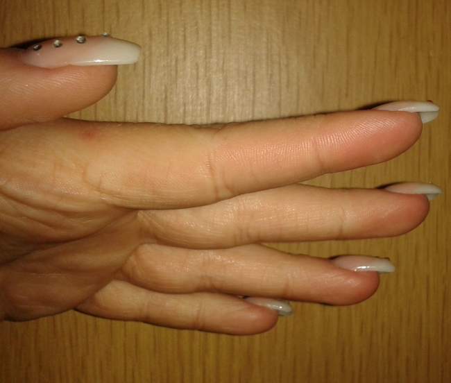 Links Seitenansicht. Neumodellage mit UV-Gel, Schablone, Cover und French,  Modellagen bei mir selbst - alles, nur nicht ideal in Anfänger Nageldesign