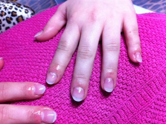 nachher Nagelbeisermodellage in Anfänger Nageldesign