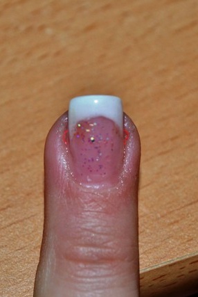 Hier habe ich versucht einzuzeichnen, welche Dellen ich meine.
ziehe ich die  Kann die Modellage den Naturnagel verformen? in Nageldesign