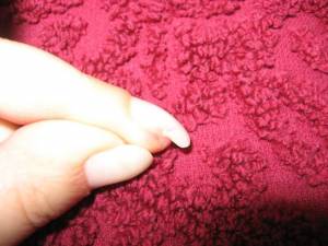 Mittelfinger links (Rand abgeschnitten) Meine Nägel nach 9 Tagen in Gelnägel