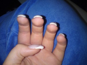  4.Refill - French - Schiefen Finger bearbeitet in Anfänger Nageldesign