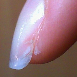 der rechte zeigefinger Extrem eingerissene Naturnägel! in Nagelkrankheiten