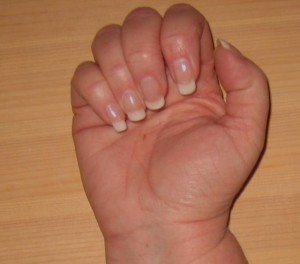 Gesamtansicht Naturnagelverstärkung mit Acryl in Anfänger Nageldesign