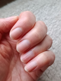 Nach Entfernung mir original Manucurist Remover Led Nail Polish von Manucurist Paris in Nagellack / UV