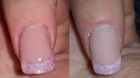 Ich liebe vorher-nachher-bilder...fällt fast gar nicht auf :)
Rosa-Pink  1-Finger Projekt in Anfänger Nageldesign