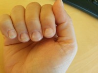 Rechte Hand - Gel löst sich am Mittel-, Zeige- und Ringfinger Erstes Mal Gelnägel - miese Qualität? in Gelnägel