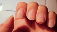 reparierte Fingernägel von oben, am Zeigefinger schimmert noch der Bruch durch Naturnagelbruch an der linken Hand in Nagelmodellagen