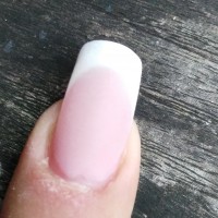 oben Entzündete Nagelhaut - Gelmodellage Feedback in Gelnägel