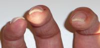 rechte Hand von vorne Refill - zu dünn? in Anfänger Nageldesign
