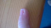 Kleiner Finger Nagelhaut komisch in Maniküre