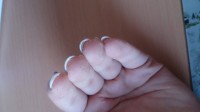 Tunnelsicht Finger French Nails mit Glitzer in Anfänger Nageldesign