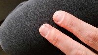 Zeige-und Mittelfinger Gelnagel abgegangen in Anfänger Nageldesign