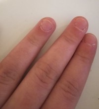 Nägel meiner linken Hand (noch recht kurz) Wie werden meine Nägel wieder schön? in Nägel kauen