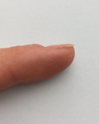 Zeigefinger 2 Nagelhaut wächst nicht mehr nach in Nägel kauen