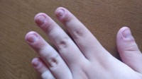 N4 Künstliche, "echte" Nägel für Nägelkauer  Männer  in Nägel kauen