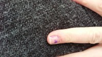 Ringfinger mit Farbe im NN Schmerzen mit UV Lack im Naturnagel in Nagellack / UV