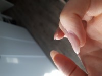 Seitenansicht kleiner Finger Naturnagel zu dünn gefeilt? Oder was anderes? in Acrylnägel